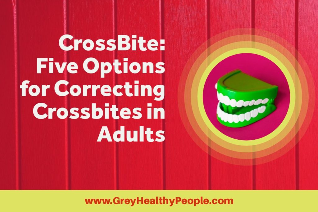 Crossbite corrections in adults