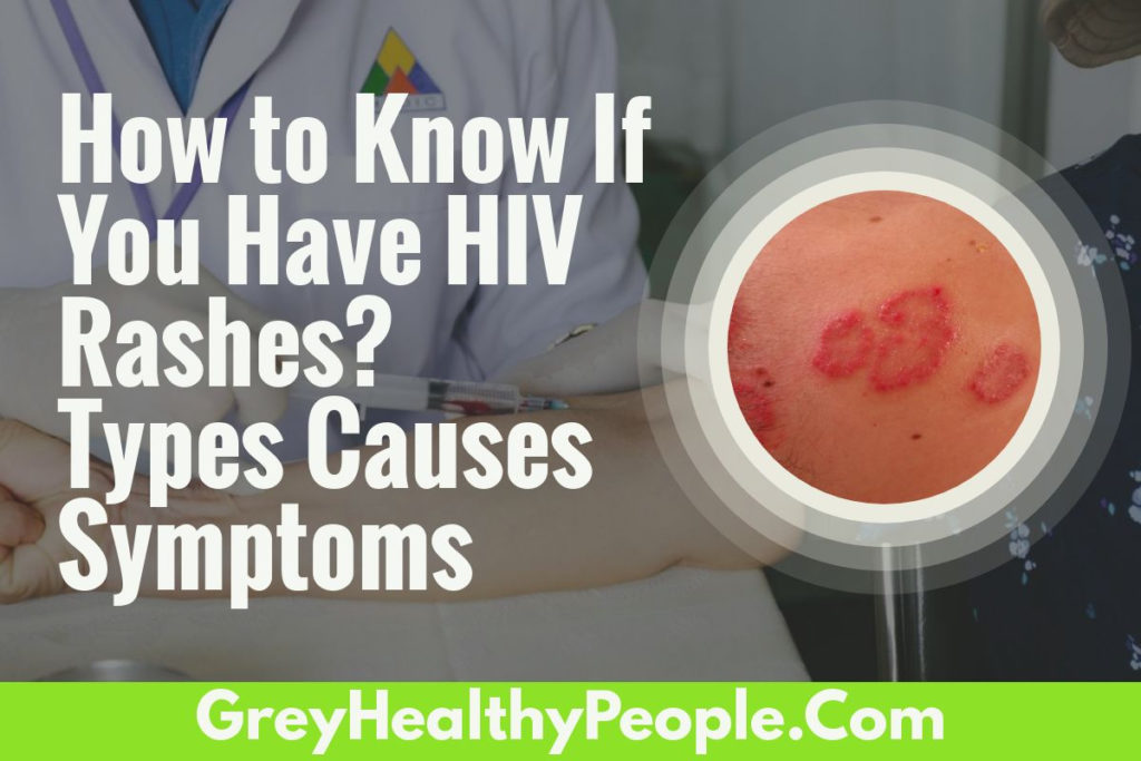 HIV Rashes, Types, Symptoms, Causes