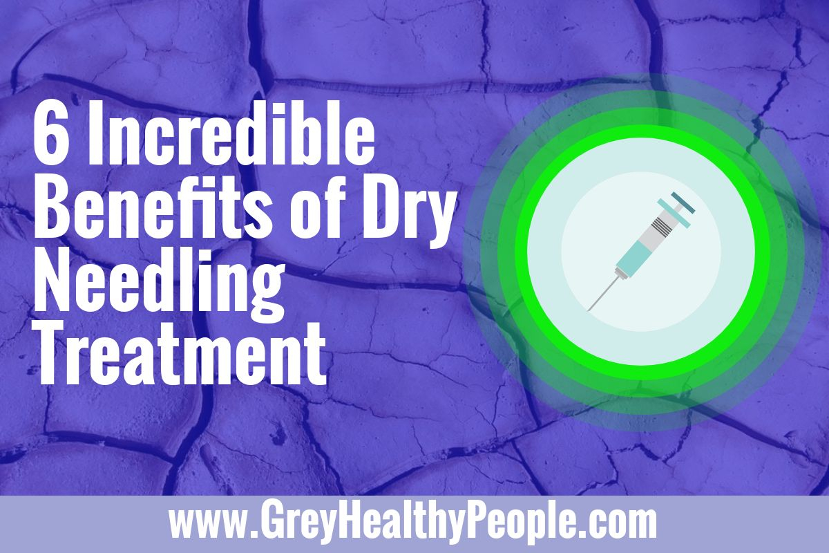 benefits of dry needling