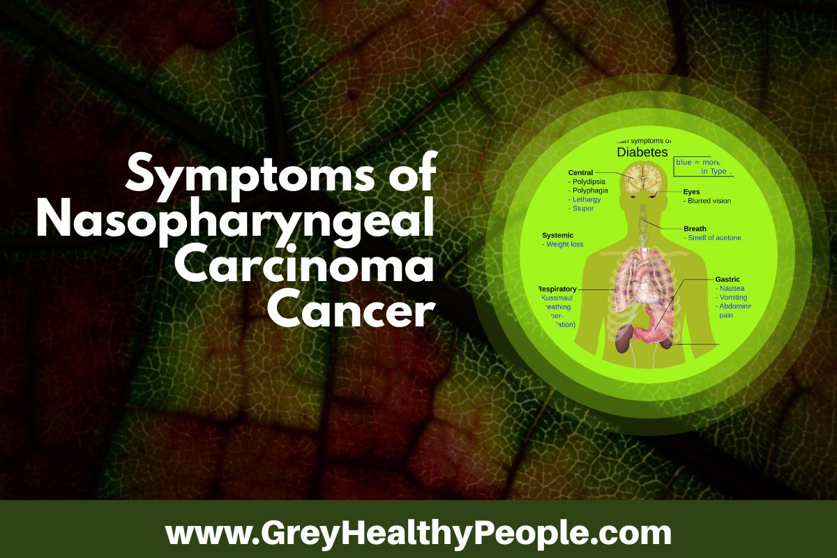 carcinoma cancer